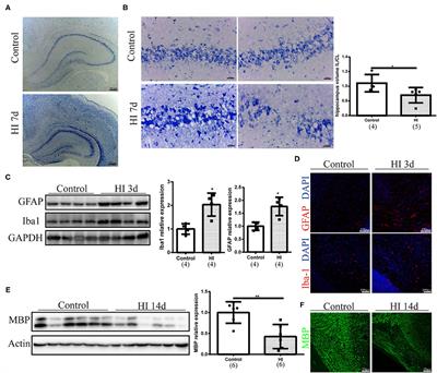 Src Family Kinases Inhibition Ameliorates Hypoxic-Ischemic Brain Injury in Immature Rats